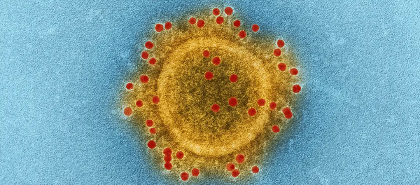 Coronavirus Is the Voice of the World Picture