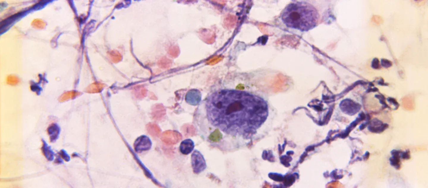 Do cells have cognitive worlds? Picture