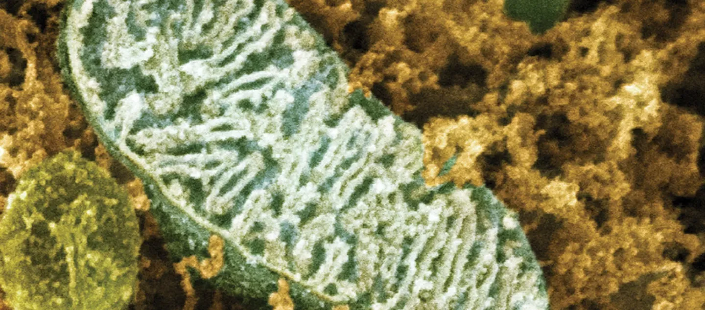 Into the Bacterial Universe Picture